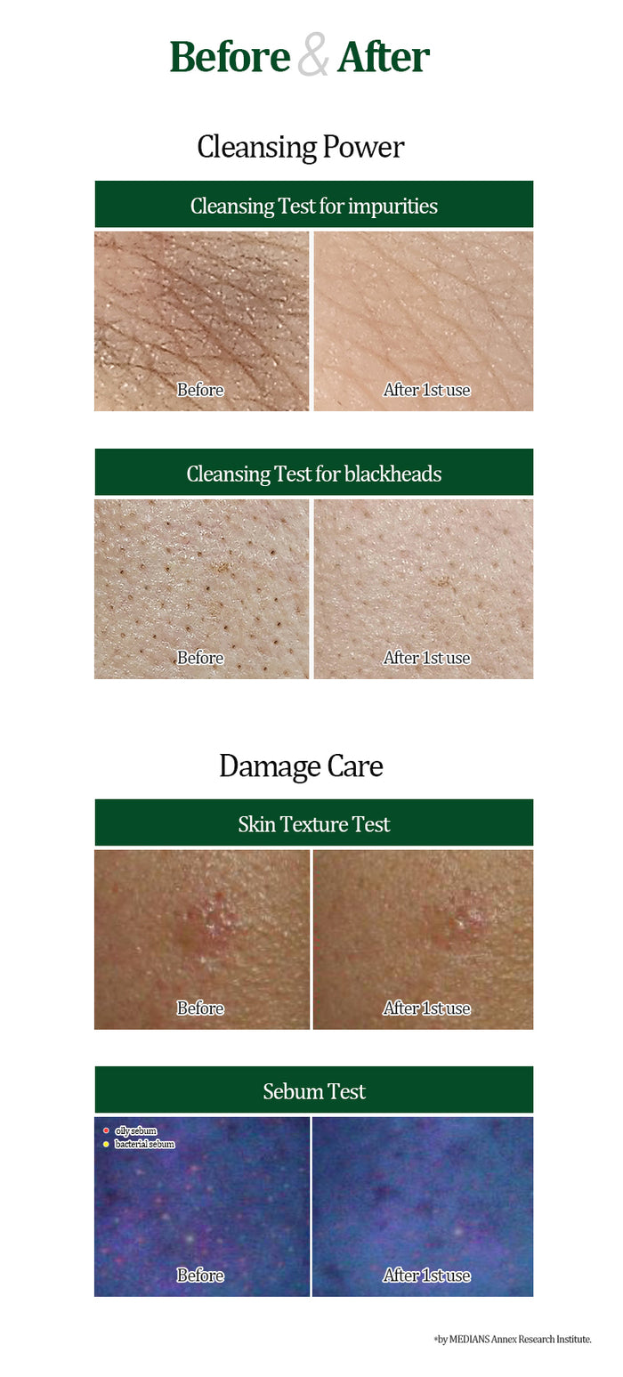 Azulene Calming Cleanser